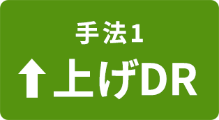 手法1上げDR