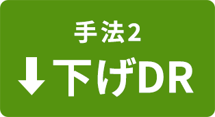 手法2下げDR